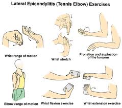 Tennis Elbow Exercises Chart